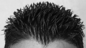 Image of Hair Restoration